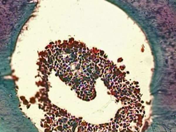 magnification of sea snake cloaca