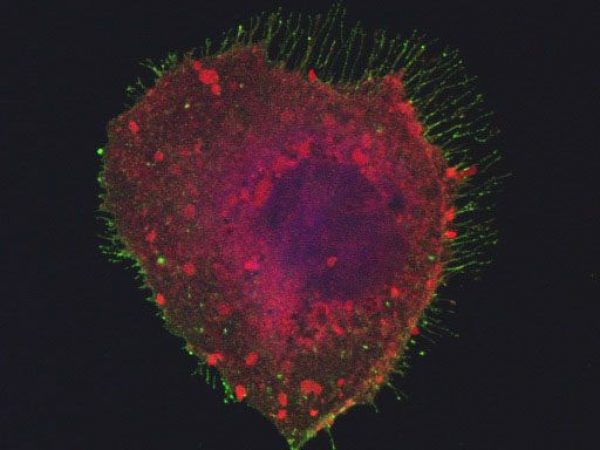 Fluorescence microscopy picture of stained cells