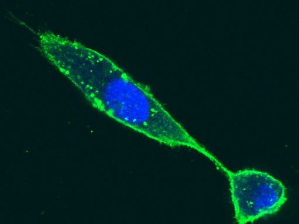 Fluorescence microscopy picture of stained cells