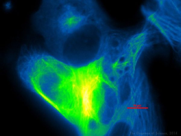 microtubules in a bone cell