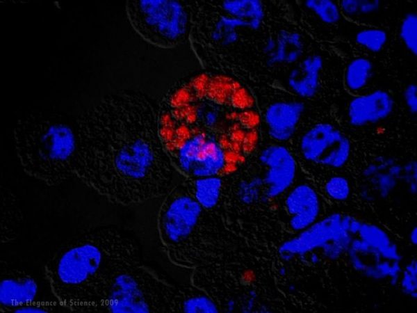 magnified cells and infection