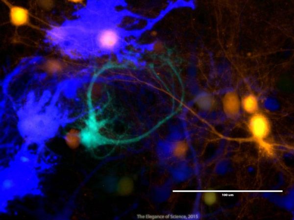 visualization of brain cell activity