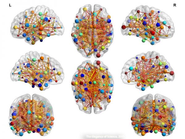 visualization of brain networks