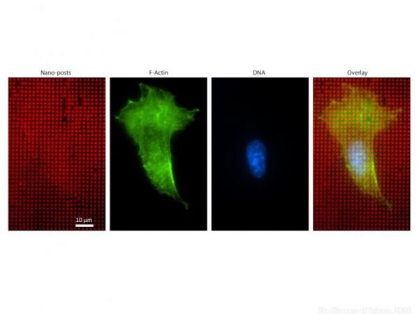 fluorescent images of a mouse fibroblast