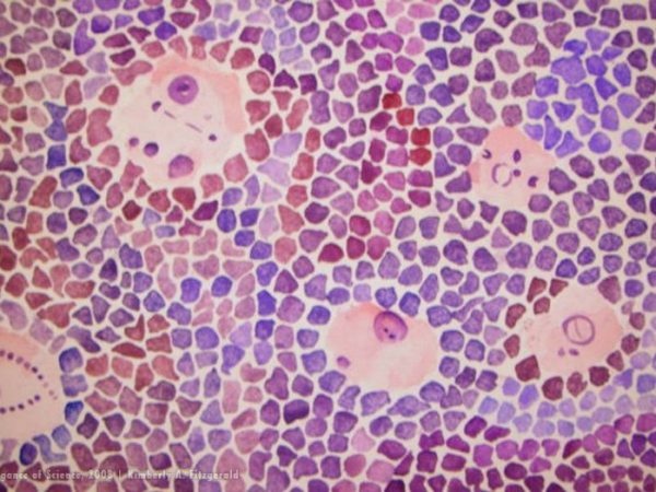 painting imagining magnified tissues