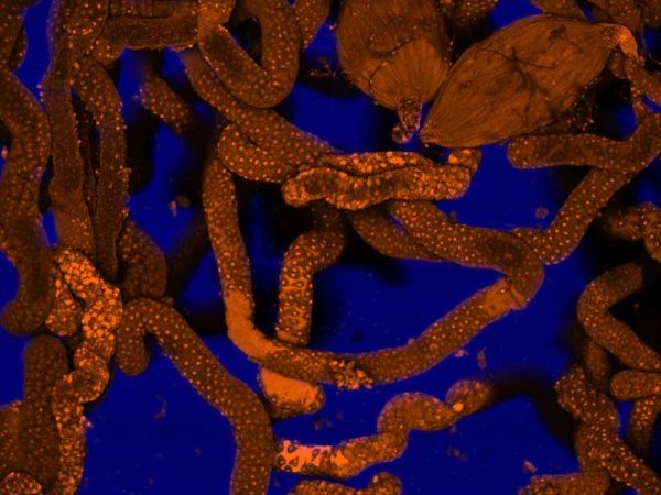 Magnification of a wasp venom gland