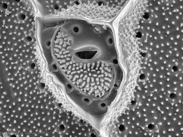 electron microphotograph of dinoflagellate