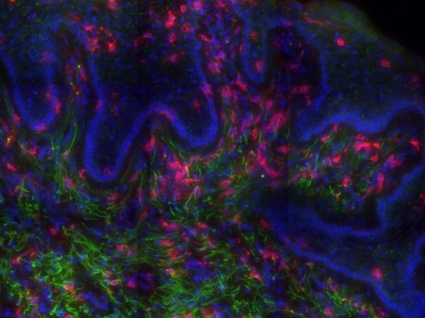 magnified tissue from a rhesus macaque