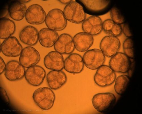 magnified blueberry pollen