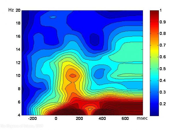 EEG (“brain wave”) frequency bands
