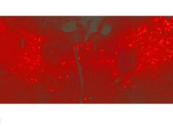 magnified rat brain tissue