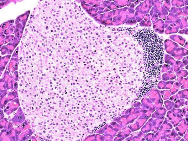 magnification of stained mouse pancreas tissue