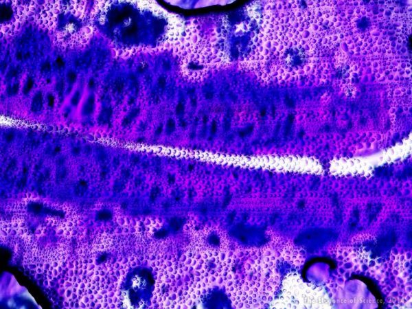 moisture captured between a slide and the dyed specimen