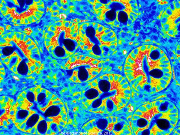 magnified colorized human intestine