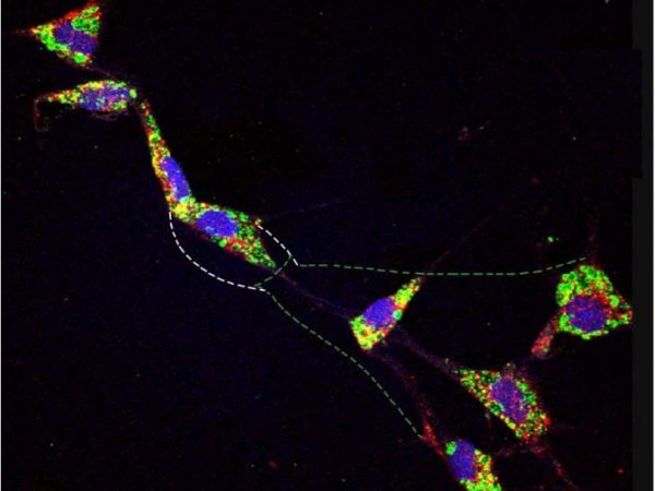 colorfully illuminated cultured cells