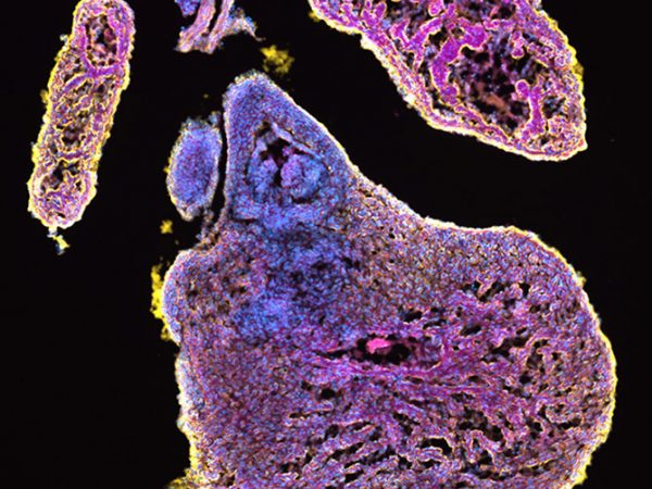Bubblegum Heart by Deanna Bousalis: This is a section of embryonic mouse heart tissue stained with antibodies specific to cell nuclei and the proteins laminin and actinin. The antibodies are joined to fluorophores that light up a certain color when a specific wavelength of light is shined on them. This technique allows us to identify the abundance and pattern of certain proteins of interest in our tissue, and also creates beautiful images the colors of bubble gum and cotton candy!