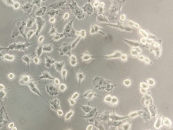 Pulling Away by Kristen Solocinski: A common way to test a hypothesis in labs is to do experiments in cells in a dish before doing them in animals. When the cells grow enough that they cover the entire surface area of the plate in which they are growing, they have to be thinned out or passaged. We do this using the enzyme trypsin, found in the digestive system to break down proteins in food, which breaks down the matrix the cells put down to attach to the dish. This picture shows cells under the microscope in the process of being trypsinized. They are starting to pull off of the plate but still cling together and are not fully removed yet.