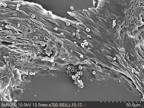 The Developing Heart by Deanna Bousalis: This is is an image of an embryonic mouse heart tissue section using scanning electron microscopy. The microscope shoots a beam of electrons at a sample that has been coated with a very thin layer of gold (or other metal), and as the electrons bounce off the gold, the device collects this information to create a representative image of the surface topography of the sample.The resulting image is a beautiful, high definition glimpse into the arrangement of cells in the tissue section! Here you can see red blood cells (the donut-shaped circles) and developing muscle cells (the oblong shapes in the top middle)!