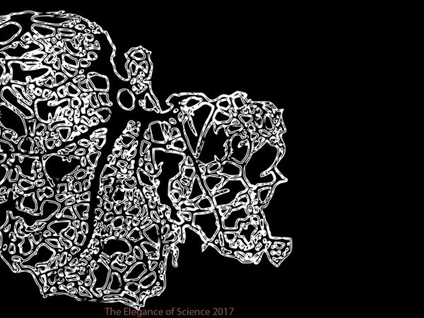 Hidden beauty of the oligodendrocyte by Pedro E Cruz: Myelin sheaths envelope axons and are crucial to the normal function of neurons. Myelin allows the high conduction of neurons up to 200 meters per second. Over time, patients with Alzheimerâ€™s Disease go on to develop severe atrophy of their white-matter tracts, which are the most highly myelinated regions of the brain. Multiple sclerosis is characterized by loss of the myelin sheaths from both the brain and the spinal cord. Oligodendrocytes produce the myelin within the Central Nervous System (CNS) and the ability to experimentally alter these cells would be of great utility within the field. Recombinant Adeno-associated virus (rAAV) vectors are powerful tools that enable gene transfer in the central nervous system. We restricted gene expression to oligodendrocytes by implementing the myelin basic protein (MBP) promoter in a rAAV vector.