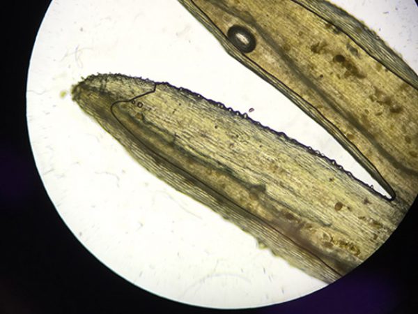 Cellular Plant Perspective 2 by Angela Skrivanek: This image reflects the tips of a plant, as seen through a microscope in Biology II Lab. The plant samples used were very small, and not much was discernible to the naked eye save their green color, thinness, and forked top. I was fascinated, however, to discover that despite the simple exterior, the plant interior was a complex network. The rectangular shape of the individual cell walls is observed, as are some chloroplasts, and younger tissue located at the tips of the stems, which serves to increase the length of the stem so that it can capture light.