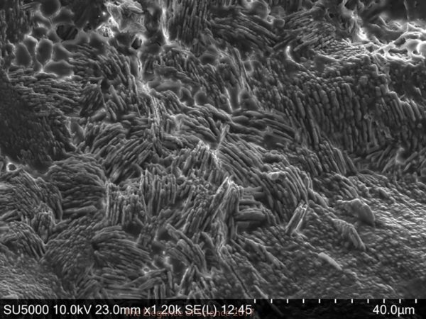 Feline Kidney Stone by Allison O'Kell: Kidney stones are an important medical problem in people and many species of animals. This is a kidney stone from a domestic cat examined with a scanning electron microscope. Electron microscopes can be used to examine structures at extremely high magnification. The kidney stone is made of calcium oxalate, which is the most common type of mineral found in kidney stones of both cats and people. Kidney stones are formed from microscopic crystals in the urine that stick together (with the help of proteins and other molecules) to form a larger stone. This stone appears to have multiple crystals stacked together forming the jagged surface. Research is ongoing to study kidney stones in cats to see if they form in similar ways to those in people.