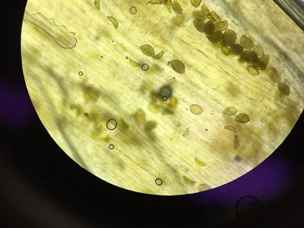 Cellular Plant Perspective 1 by Angela Skrivanek: This picture was taken through the lens of a microscope during Biology II Lab. This was an exciting lab because students were able to take an up-close look of the cellular makeup of plants. In this picture, the exterior wall of the plant and the cell walls, vacuoles, and chloroplasts of the cells making up the interior, as well as water being stored in the interior of the stem are clearly visible. What appears to be a busy highway with cars is actually moving water, nutrients, and pigment cells making their way through plant tissue.