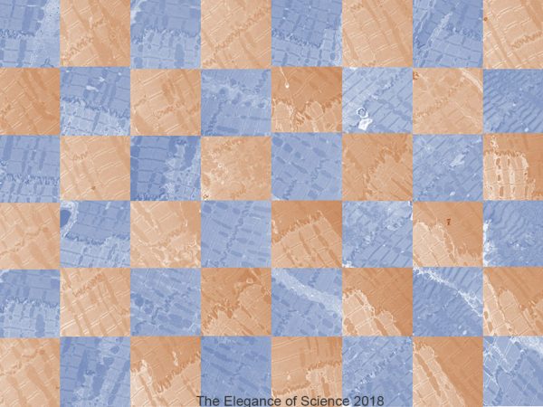 Mitochondria truly are powerhouse of the cell as they create the energy that our body requires to do almost everything. Each individual image is taken from a sample of heart tissue from Boxers and through electron microscopy, it enables us to see the inner portion of the mitochondria. The disease that I am researching is known as Arrhythmogenic Right Ventricular Cardiomyopathy (ARVC). It involves fatty, fibrous infiltration of heart tissue which ultimately causes an arrhythmia. The color of each square is pertinent as it indicates those who were and those who were not affected by ARVC. The orange squares represent those affected and blue represent those unaffected. If looked at closely, then one can see the structural differences amongst the orange squares compared to the blue. As separate entities, they are merely colored squares, but together they create a beautiful, powerful mosaic.