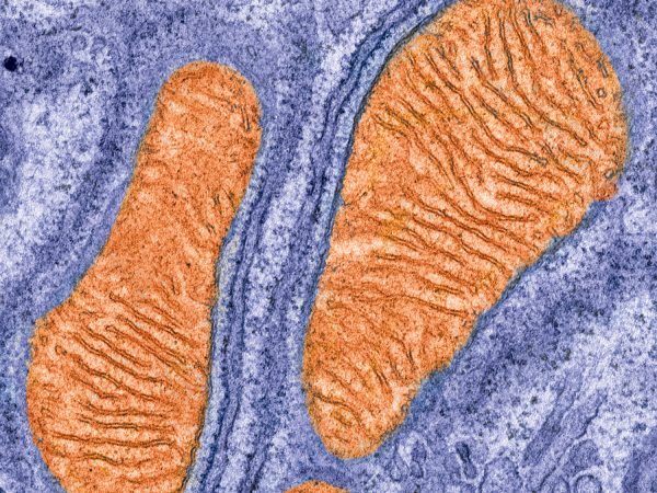 Healthy communication is crucial to life as depicted in this image that appears to be passing footprints but is actually a colorized electron micrograph of mitochondria â€“ intracellular transceivers. Although mitochondria (orange) are most well-known for the important role they play in the generation of energy for cells, they also transmit and receive vital signals to and from their surrounding environment. One example is the ability of mitochondria to communicate through calcium signaling with the rough endoplasmic reticulum that can be seen residing alongside mitochondria in this image (bumpy blue bilayers). This communication enables cells to adapt to changes in energy demand as more calcium transfer from the endoplasmic reticulum to mitochondria stimulates energy synthesis. In dire situations of intense stress, excessive transfer of calcium from the endoplasmic reticulum leads to mitochondrial calcium overload and triggers activation of mitochondrial-mediated cell death. The old adage is true â€“ communication is key!