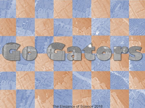 Mitochondria truly are powerhouse of the cell as they create the energy that our body requires to do almost everything. Each individual image is taken from a sample of heart tissue from Boxers and through electron microscopy, it enables us to see the inner portion of the mitochondria. The disease that I am researching is known as Arrhythmogenic Right Ventricular Cardiomyopathy (ARVC). It involves fatty, fibrous infiltration of heart tissue which ultimately causes an arrhythmia. The color of each square is pertinent as it indicates those who were and those who were not affected by ARVC. The orange squares represent those affected and blue represent those unaffected. If looked at closely, then one can see the structural differences amongst the orange squares compared to the blue. As separate entities, they are merely colored squares, but together they create a beautiful, powerful, geometric mosaic.