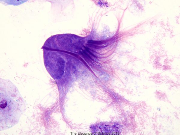 This parasite is a common 