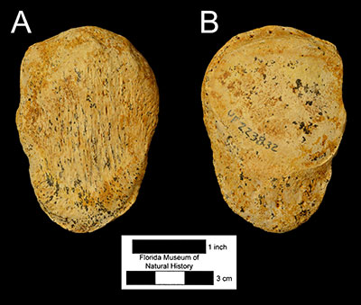 Figure 7. The patella of Xenosmilus hodsonae (UF 223832) in A) anterior and B) posterior views.
