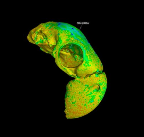 Ct scan cranium