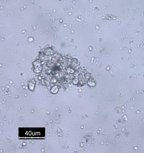 cluster of starch grains from metate
