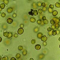 Zooxanthellae. Photo courtesy NOAA