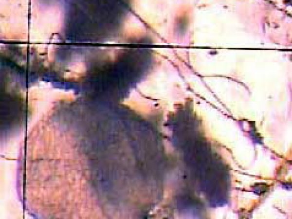 Trichoplax sp[1]. 1 Guam A Collins_1