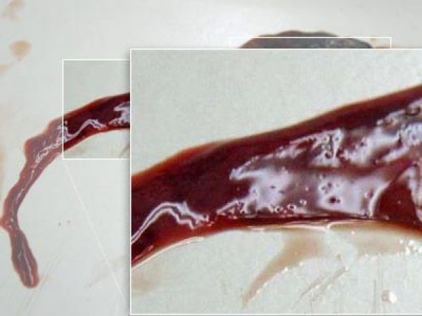 Close up: removed epigonal tissue.