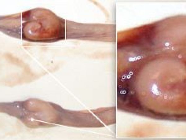 Close up: right and left nidamental glands.