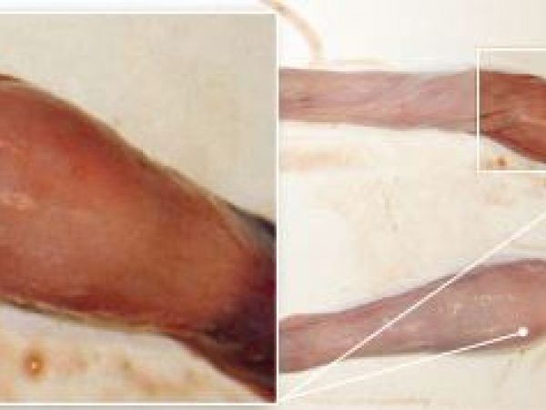 Close up: right and left uteri.