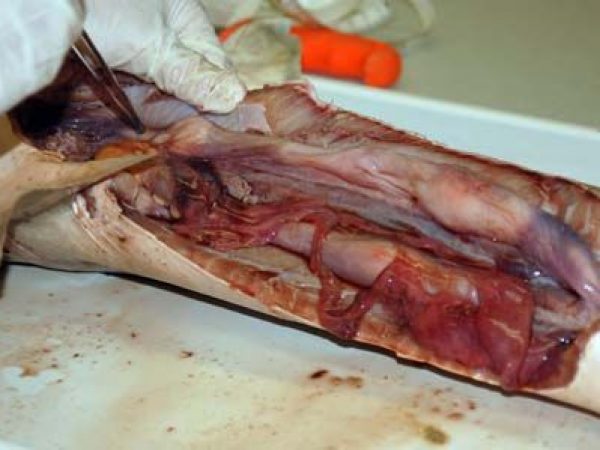 Internal view of the body cavity with the major digestive organs removed.