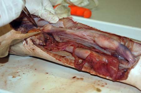 Internal view of the body cavity with the major digestive organs removed.