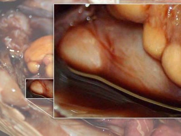 Close up: right nidamental gland.