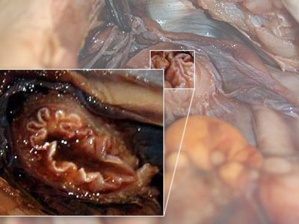 Close up: esophagus.