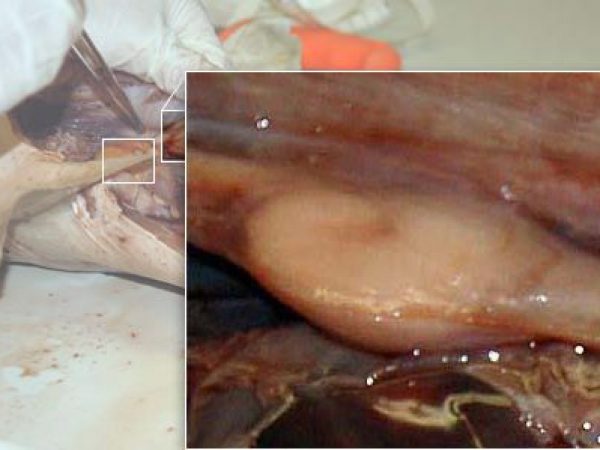 Close up: nidamental gland.