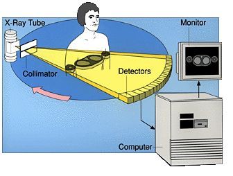 Diagram of how CT scanning works. (courtesy of Imaginis.com)