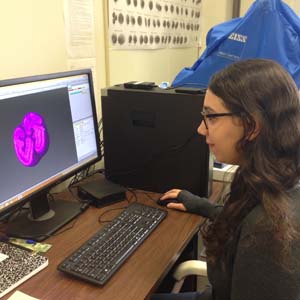 Museum intern Andrea De Renzis examines a 3D image of a rodent tooth in Avizo. (Photo courtesy of Dawn Mitchell)