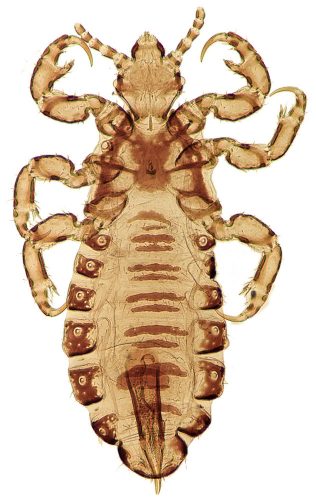 magnified louse