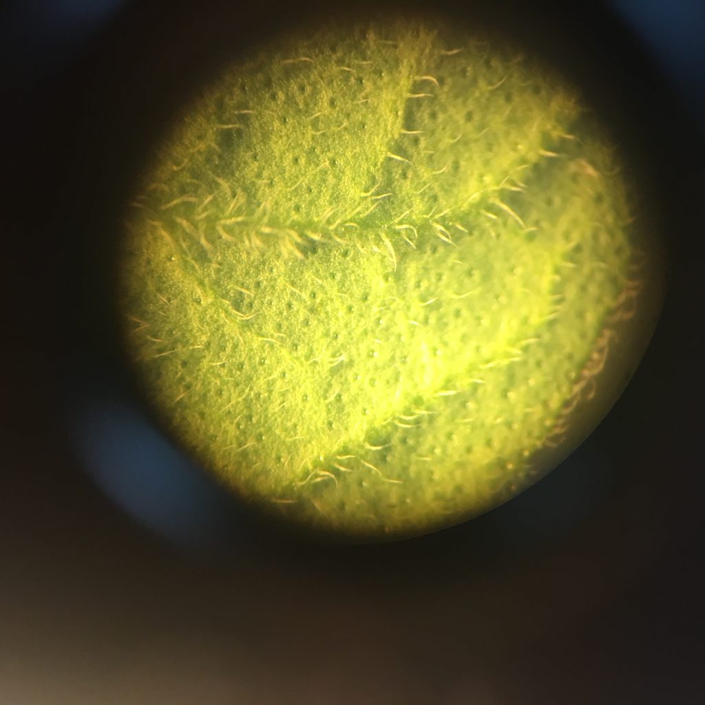 photo taken through microscope